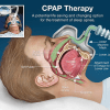 cpap machine for sleep apnea